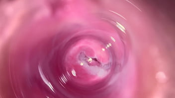 Internal camera inside vagina